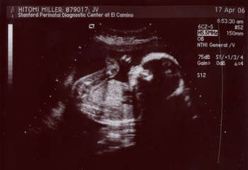 Image 2006-04-17-ultrasound2.jpg