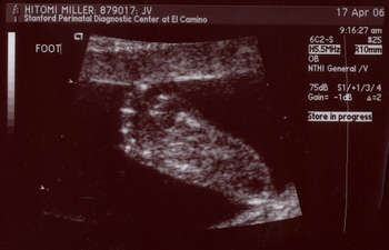 Image 2006-04-17-ultrasound3.jpg