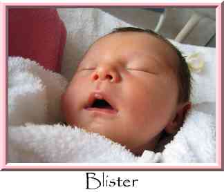 Blister Thumbnail