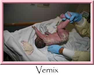 Vernix Thumbnail