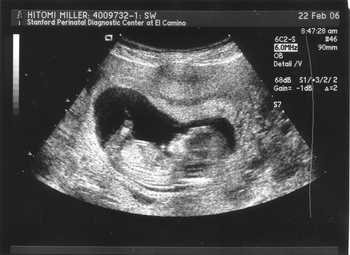 Image Ultrasound1.jpg